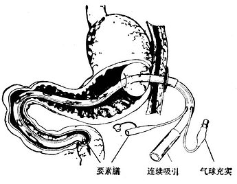 吃胃药后不宜多喝水